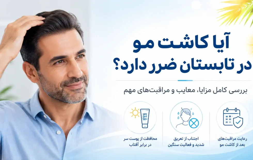 آیا کاشت مو در تابستان ضرر دارد