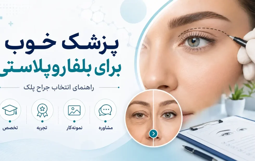 پزشک خوب برای بلفاروپلاستی