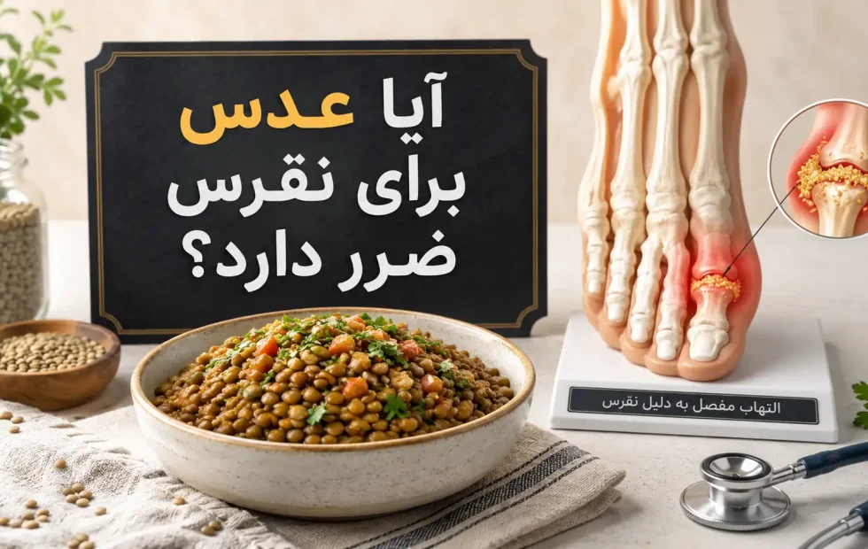 آیا عدس برای نقرس ضرر دارد