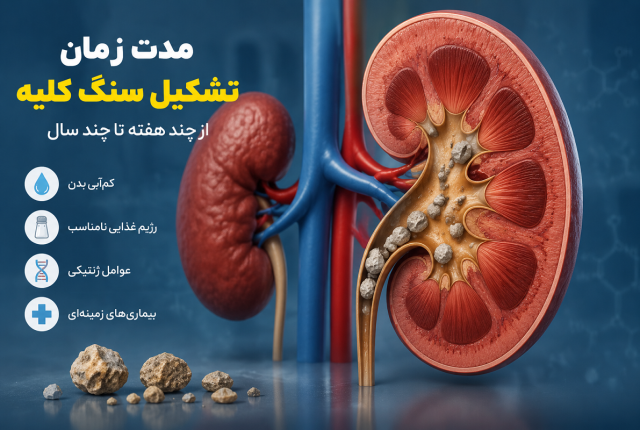 مدت زمان تشکیل سنگ کلیه