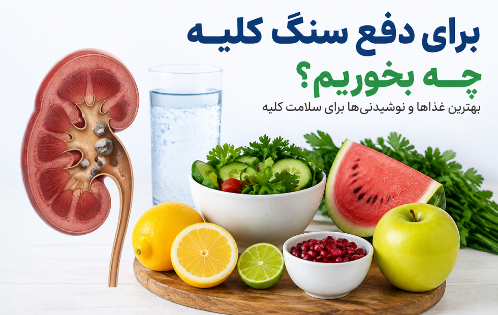 برای دفع سنگ کلیه چه بخوریم؟