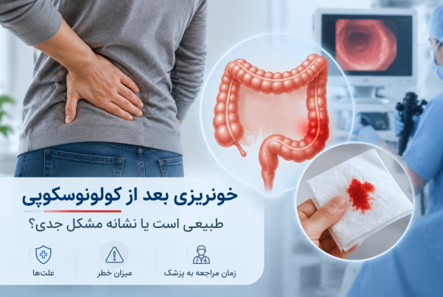خونریزی بعد از کولونوسکوپی