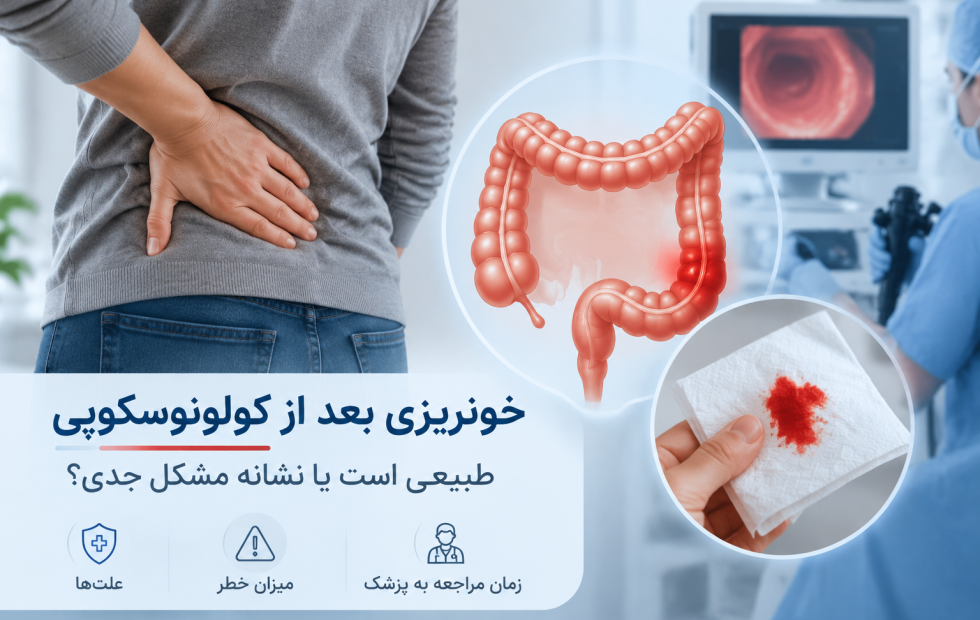 خونریزی بعد از کولونوسکوپی